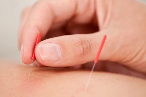 disability insurance acupuncturists