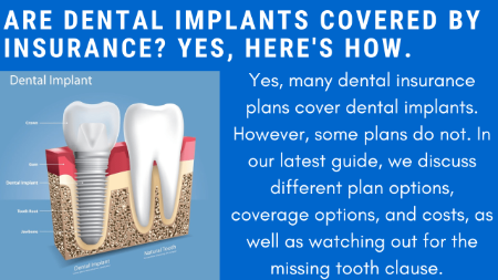 Yes, Dental Implants Are Covered By Insurance | The Ultimate Guide To Getting Dental Implants Covered By Dental Insurance